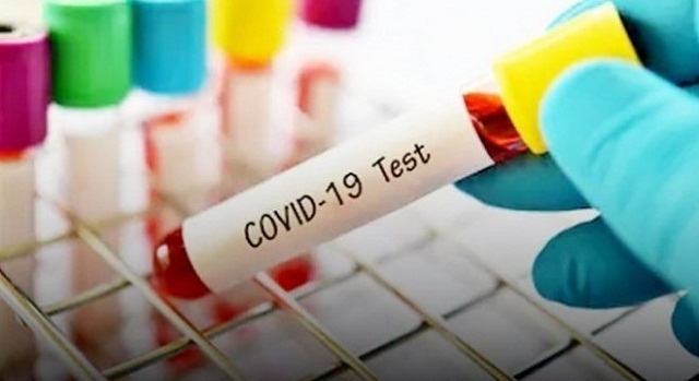 Covid-19.1 Kembali Bertambah Kasus Terkonfirmasi Covid-19 Kab. Solok